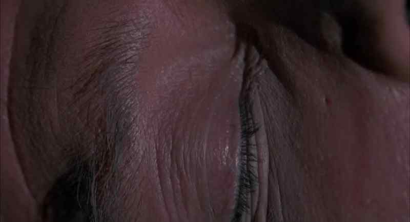 Does this hurt? You have a hematoma there