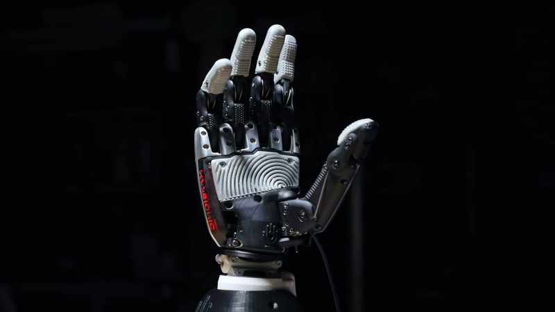 [Downey] Currently, most advanced prosthetic hands