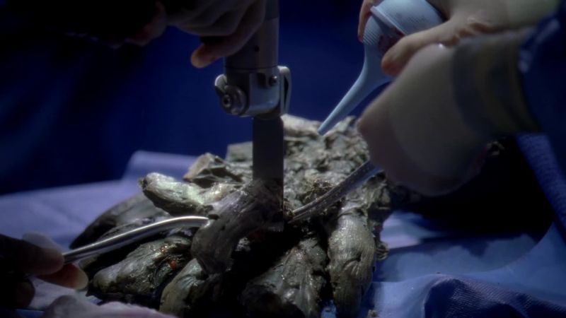 Dr. Bailey, how can you tell