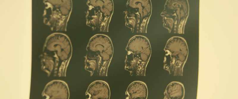 DR. GEOGHEGAN: I believe we are talking about