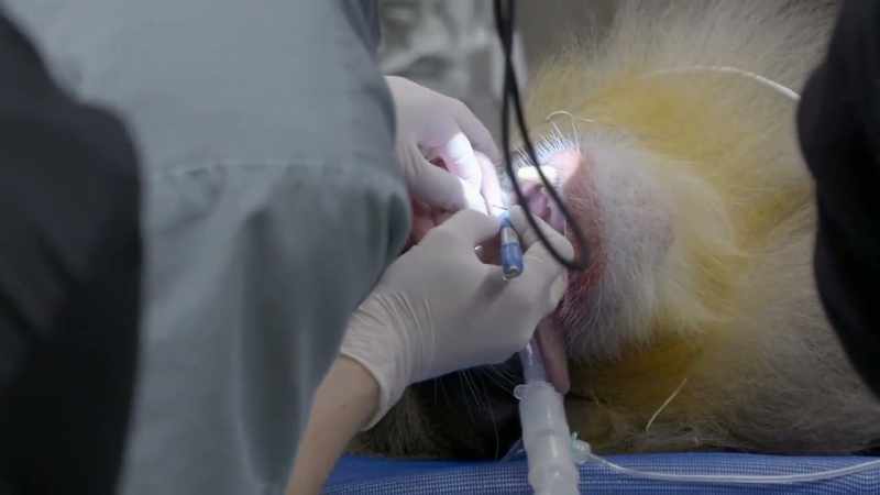 Dr. Jamie: So we definitely have some retained roots