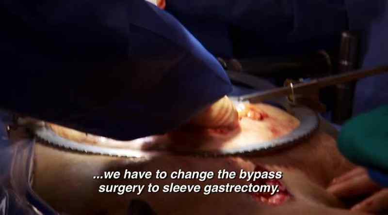 Dr. Nowzaradan: PUSH IT BACK JUST ABOUT AN INCH