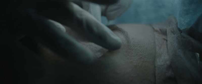Dr. Sabom: They had these things in her ears