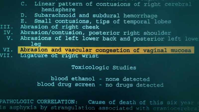 Dr. Spitz: It's quite evident that there has been an assault