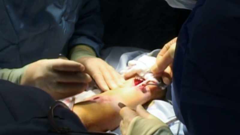 Dr. Warwick transplants
