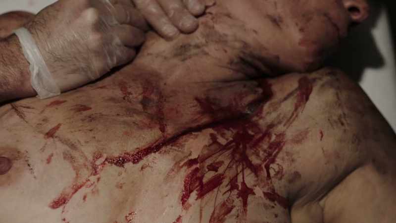 Draw some blood and get it back to me as quick as possible