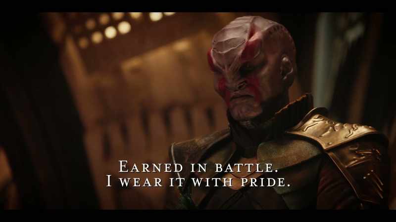 Earned in battle. I wear it with pride