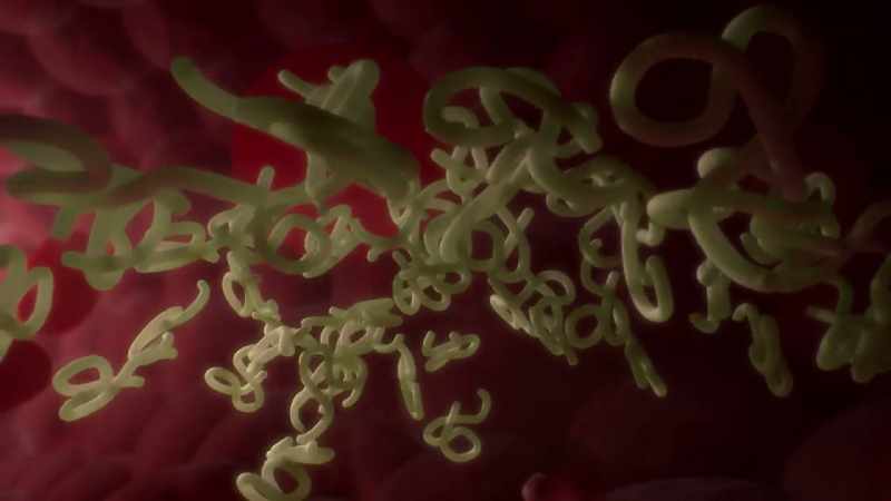 Ebola's assault is merciless