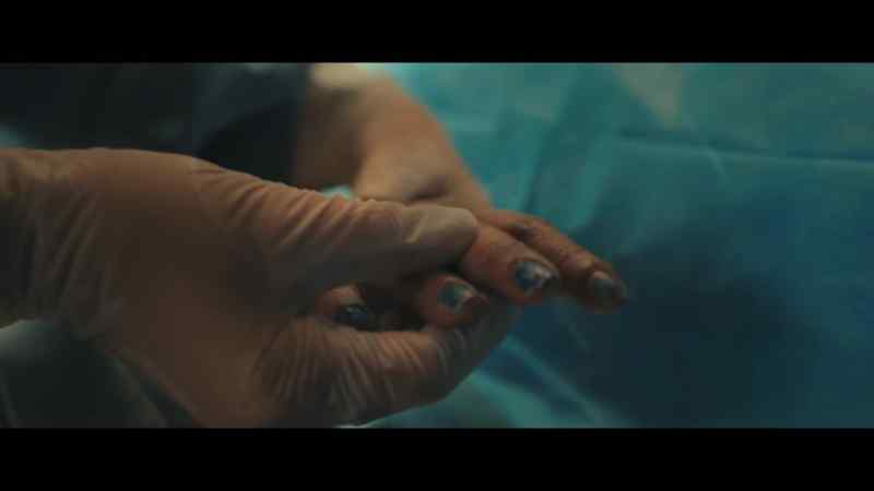 [echoing] There is obvious signs of debris under the nails