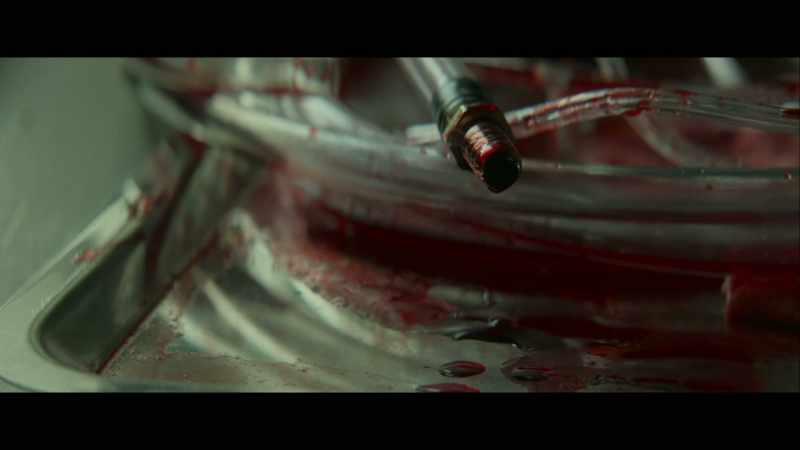 ECMO port capped