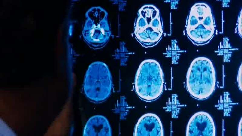 Egnor there's nothing to be learned in neurosurgery