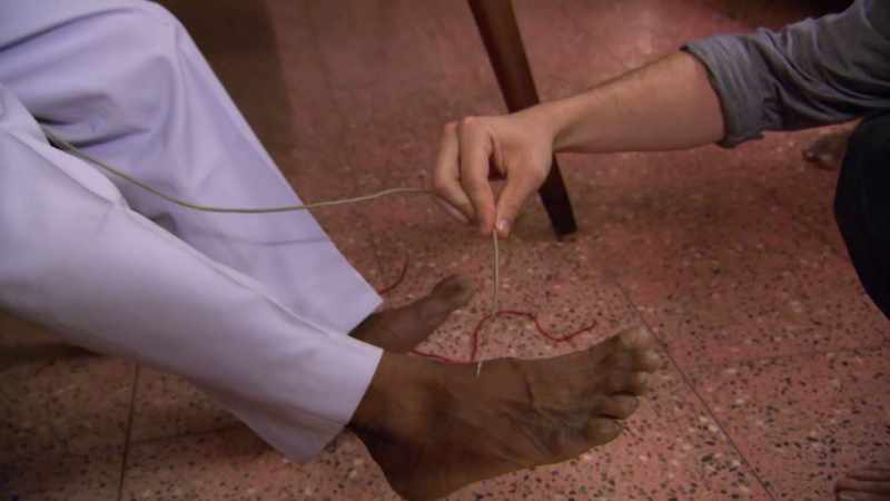 (electrical current pulsing)