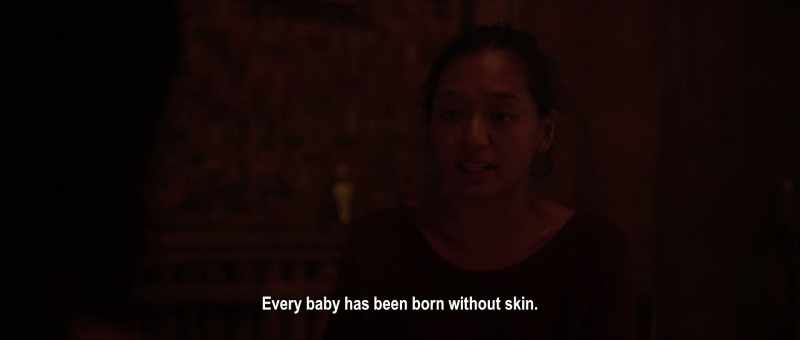 Every baby has been born without skin