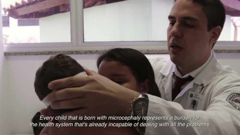 Every child that is born with microcephaly represents a burden for the health system