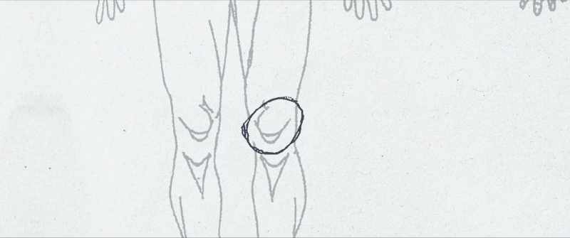 Everyone that went in there had a herniation, a bulging disc
