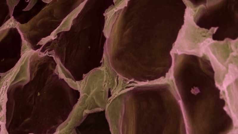 Fat cells travel to the liver
