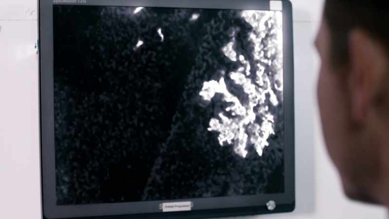 [Ferdinand] No, the protrusions