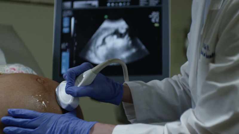 Fetal position is head down
