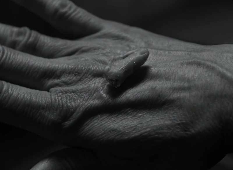 Finger of birth-strangled babe