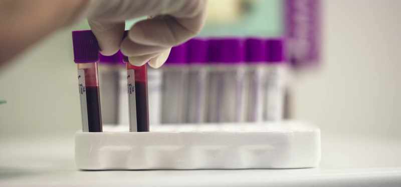 First come blood tests, then more blood tests