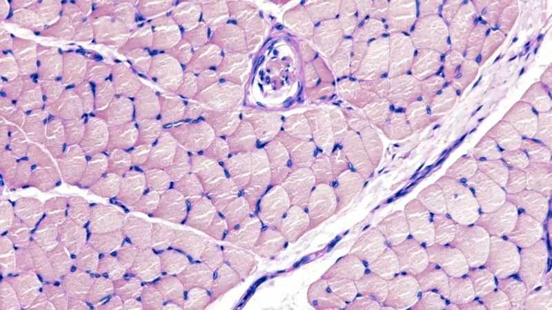 For instance, some cells have found a way to increase surface area