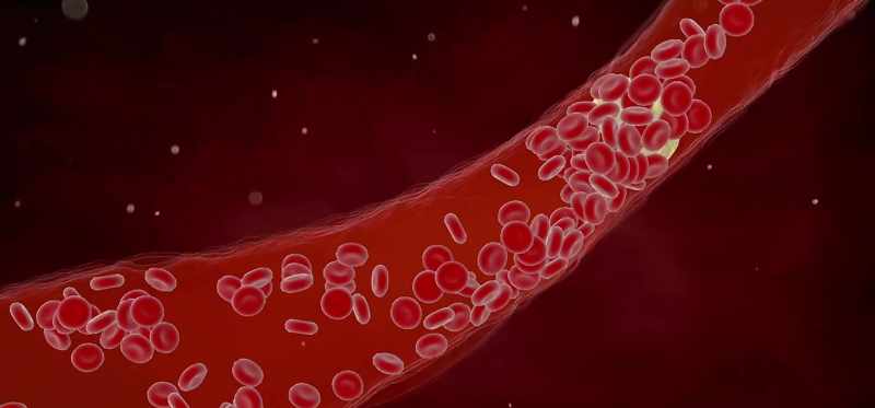 For instance, the person could have a clotting disease
