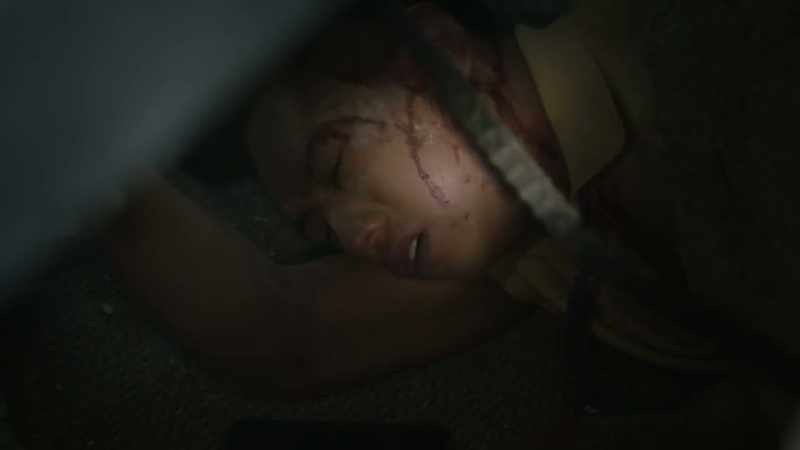 Frankie! Where are you hurt?