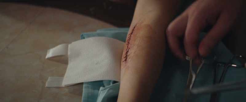 Frankie, will you please tell her what happened?