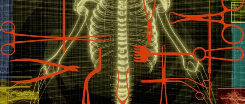 From my lumbar Sspinal-fusion surgery