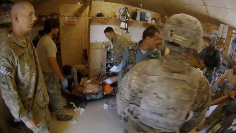 Fully blew out his abdominal wall and his bowels, intestines