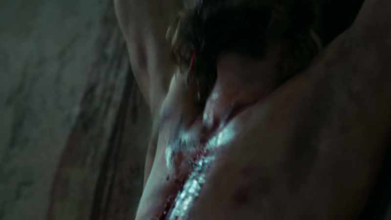 [ Gagging ]
