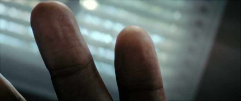 Genetic transversion expressed in the skin
