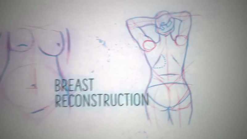Gina opted for reconstruction, which involved removing tissue