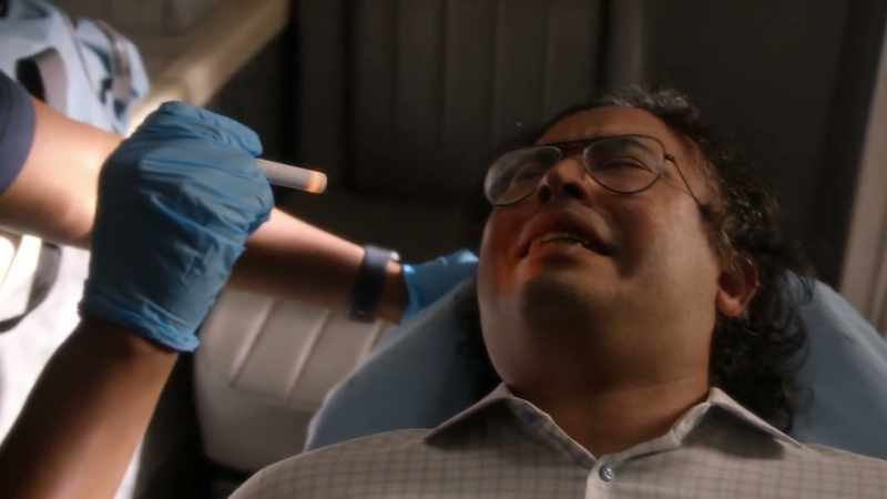 Gingival hyperplasia