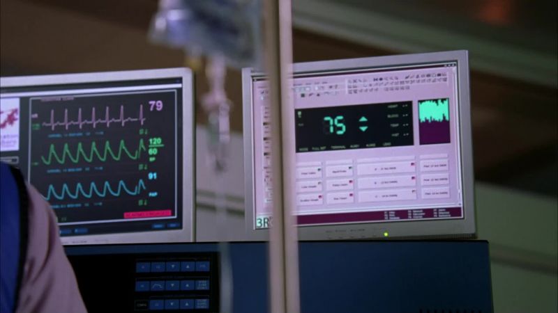 Glucose is holding steady at 75
