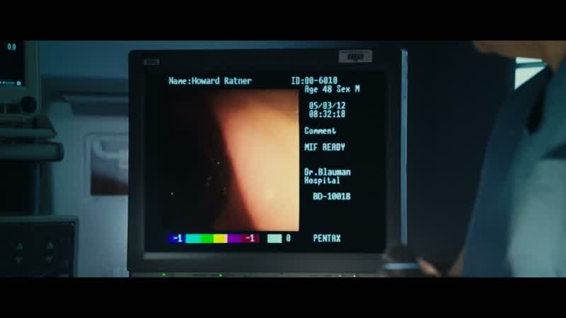 Going up the sigmoid colon