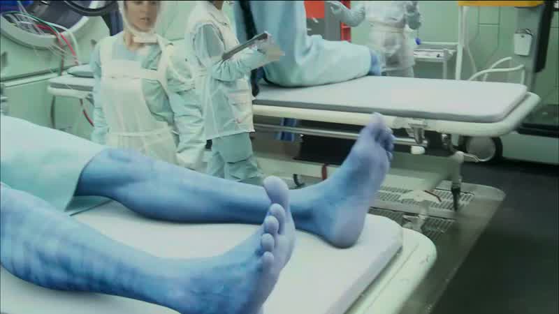 Good distal motor control