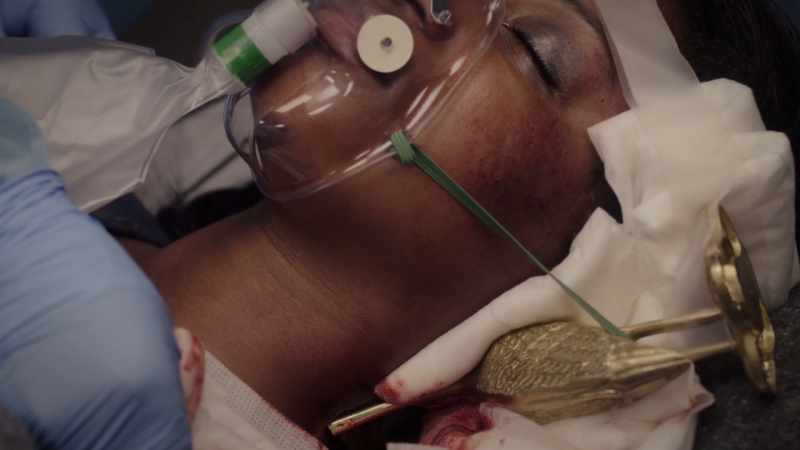 good-thing-it-nicked-carotid-what-it