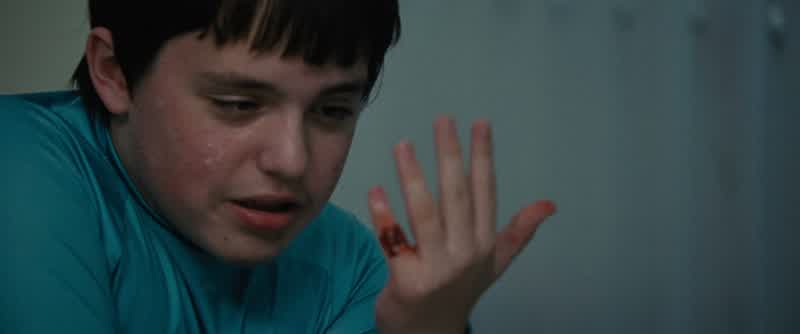 Had a boo boo