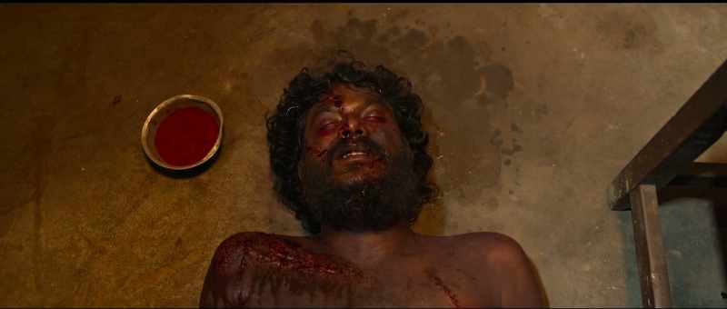 Had he been alive and chilly powder was poured into eyes