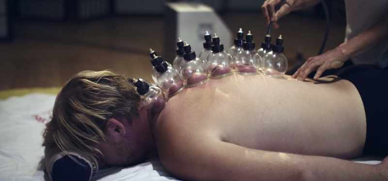 Have Chinese herbs, get cupping. Crazy suction