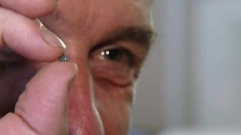 He has a processor inserted into his wife Irena