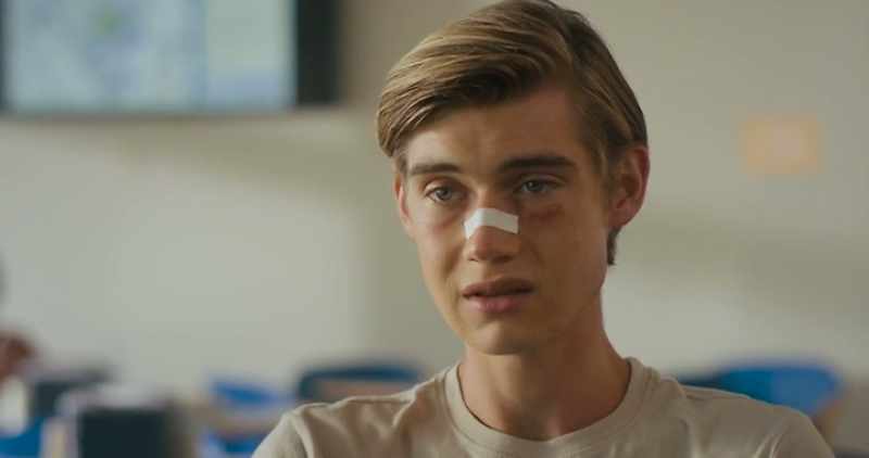 He assaulted you. Man the fuck up, Brian