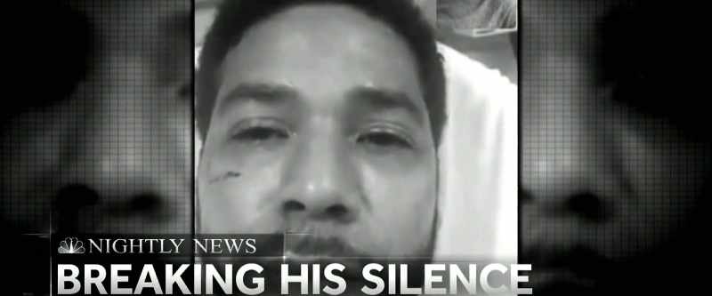 He was brutally beaten by attackers