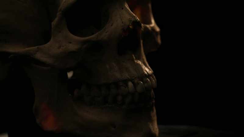 He had this ancient skull