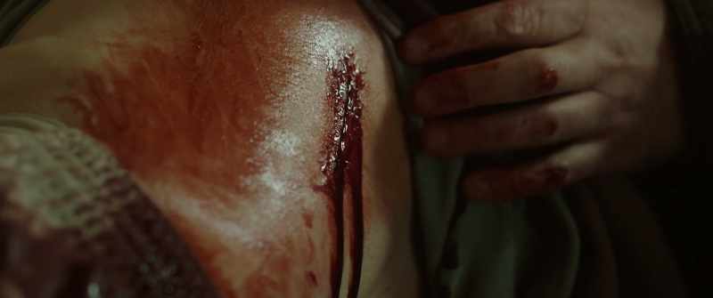 He hurt me