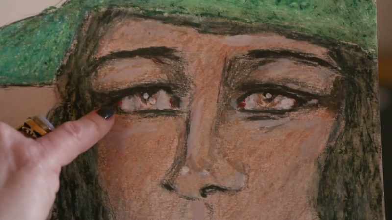 He often draws petechial hemorrhaging