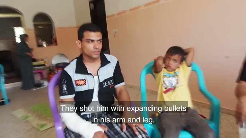 He was shot with explosive bullets in the arm and right leg