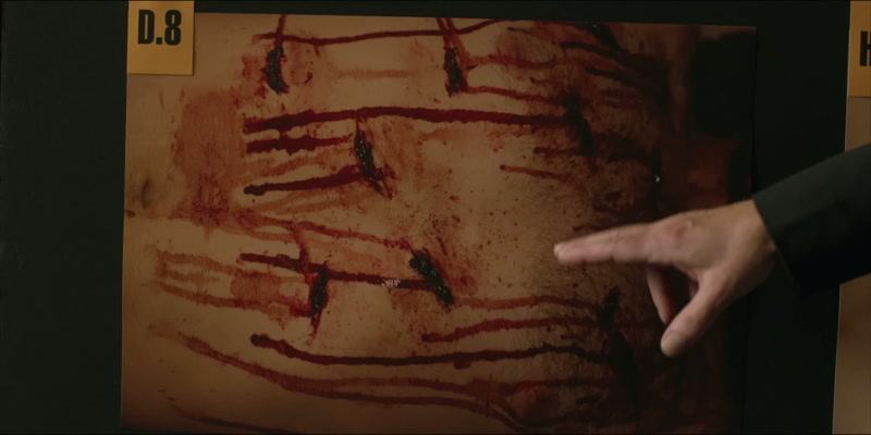He was stabbed so many times