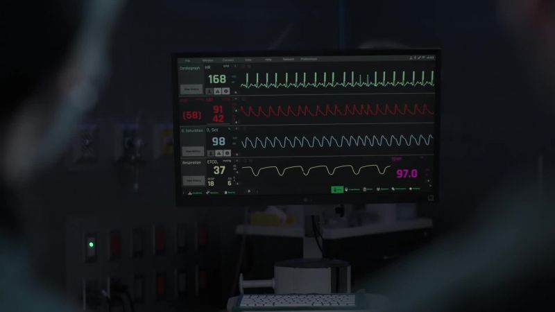 Heart rate 168